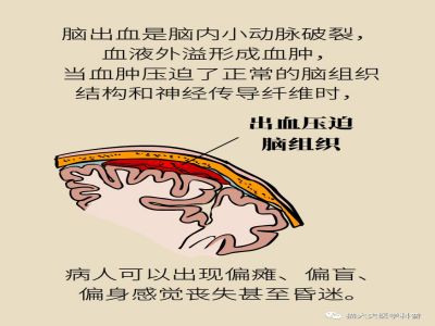 423730a9ecf84f3385802d517e5e27fd