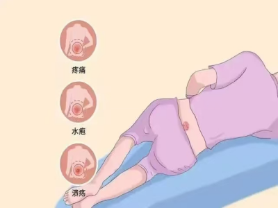640