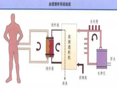 透析.jpeg