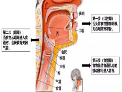吞咽障碍