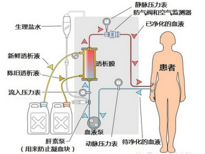 血透.jpg