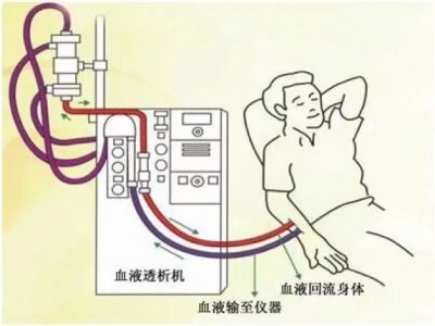 血透