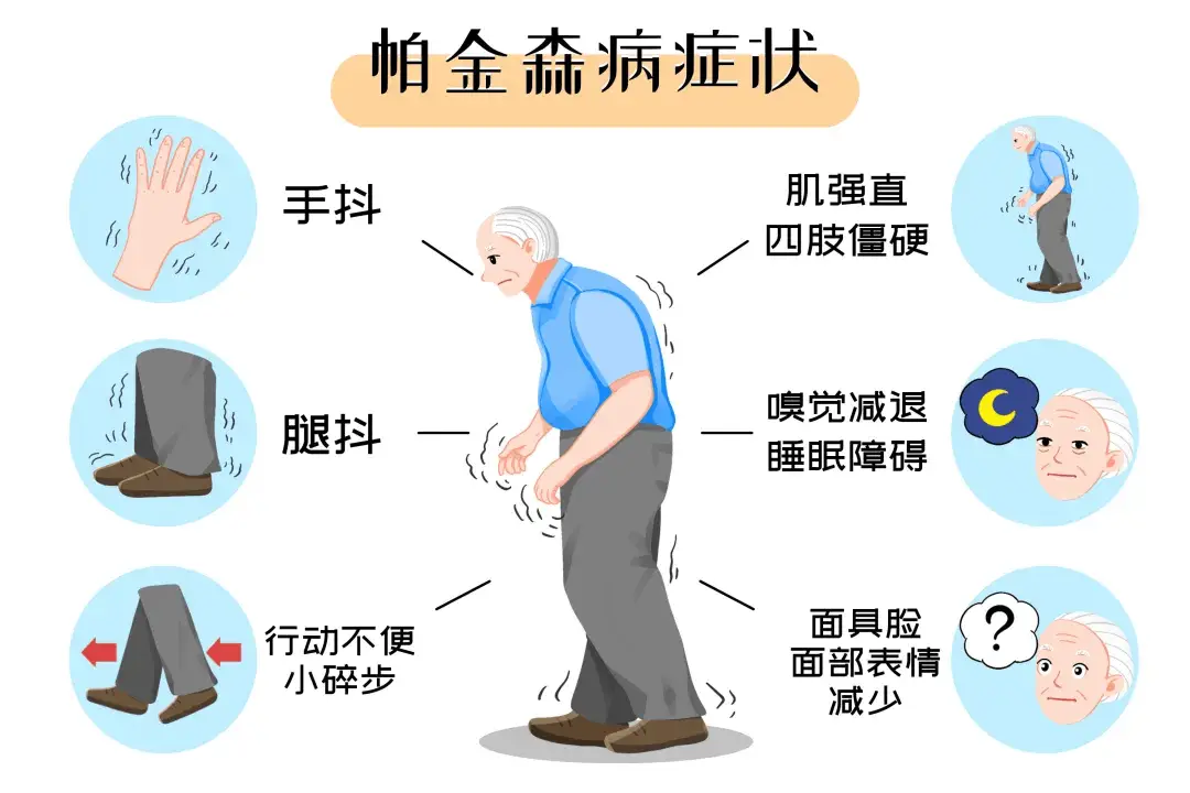 帕金森症状