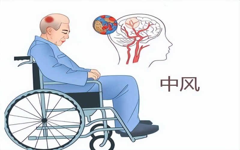 中风