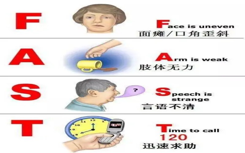 脑卒中急救