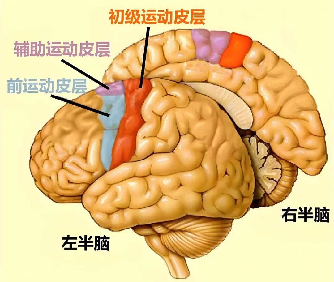脑梗1