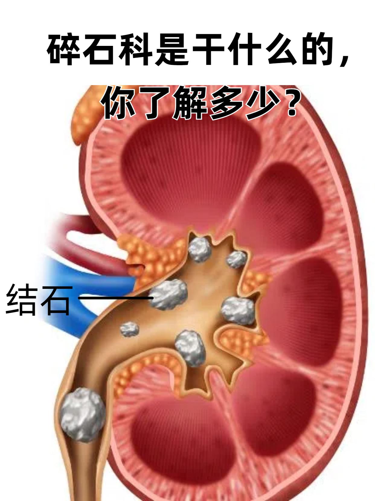 4d0411203c05f79349c53e28c71edc87