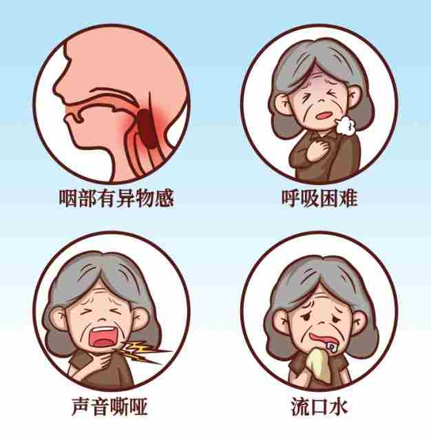 吞咽障碍