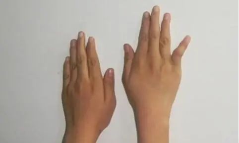 640