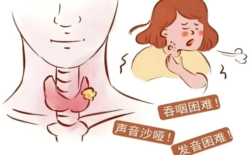 吞咽障碍