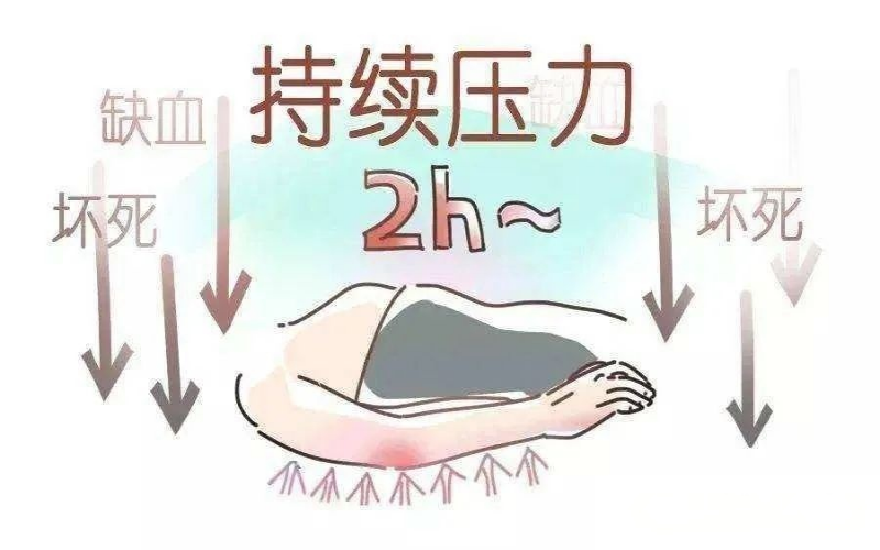 压疮